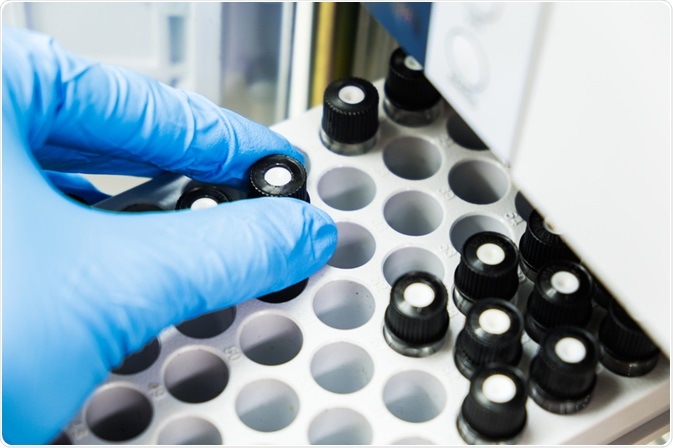 liquid chromatography