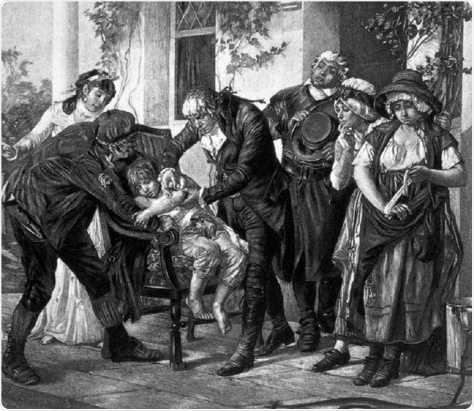 EDWARD JENNER ( 1749- 1823), Physician and pioneer of vaccination, vaccinating 8 year old James Phipps with cowpox to provide immunity against smallpox, 1796. - By Everett Historical