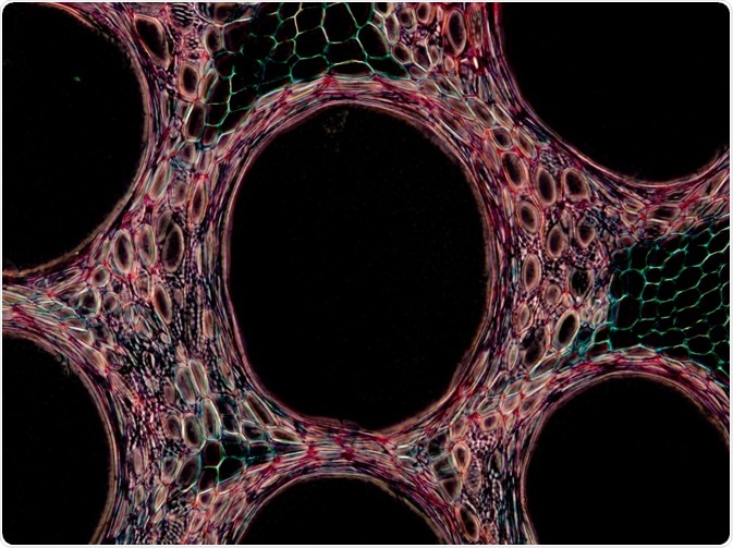 E-FRET is a more powerful version of FRET and is used to study protein interactions.