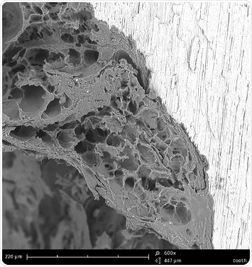 This is what a tooth filling interface looks like with an electron microscope
