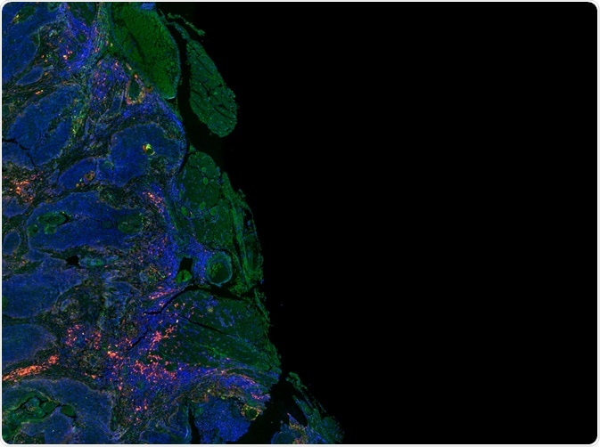 Immunofluorescence can be used to detect proteins of interest