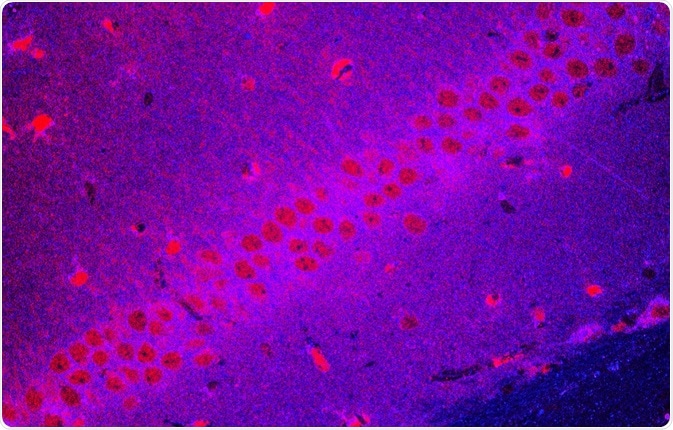 Cytoophidia are filamentous structures present inside a cell.