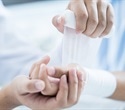 Targeting bacterial communication may offer antibiotic-free wound therapy