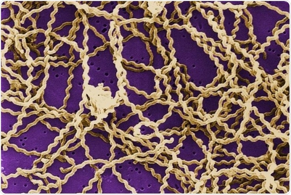 Researchers shed light on evolution and diversity of Leptospira bacteria