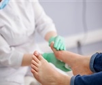 Bunions and Bunionettes: What’s the Difference?