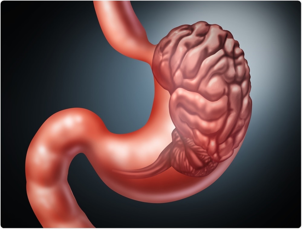 Abstract image of the gut-brain axis