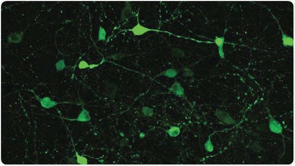 Study uncovers new hunger pathway in the brain