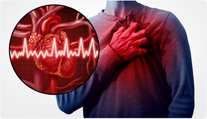 Image Credit: Lightspring