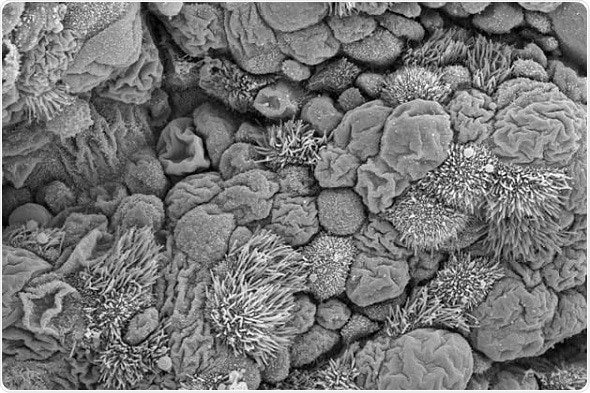 Antibiotics can wipe out early flu resistance, study finds