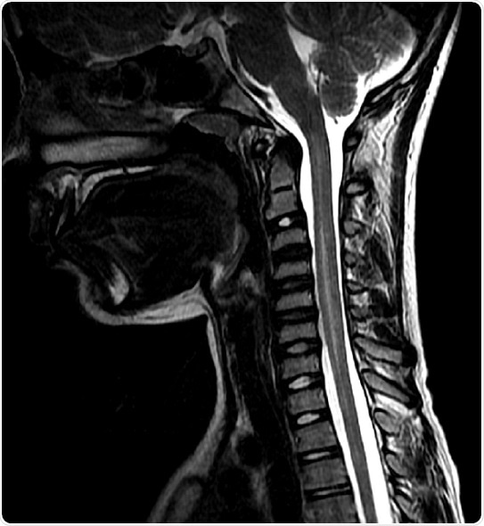 Johns Hopkins co-leads study on