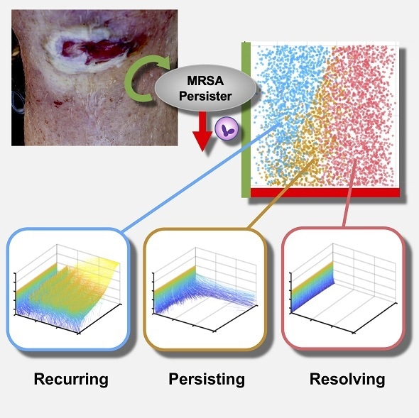 Mathematical model helps identify determinants of persistent MRSA bacteremia