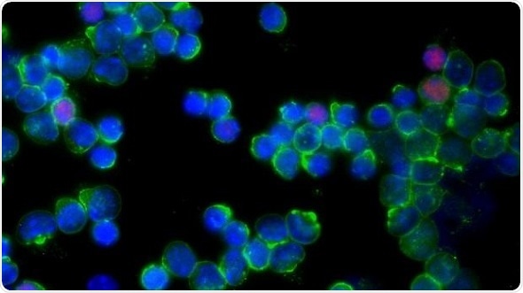 Cancer Research UK Convergence Science Centre announces tumor liquefying microbubbles