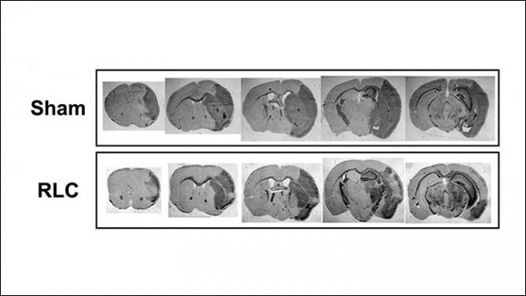 Regulating blood supply to limbs after stroke improves functional recovery Regulating blood supply to limbs after stroke improves functional recovery