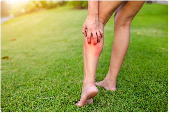 Image Credit: NamtipStudio / Shuttterstock