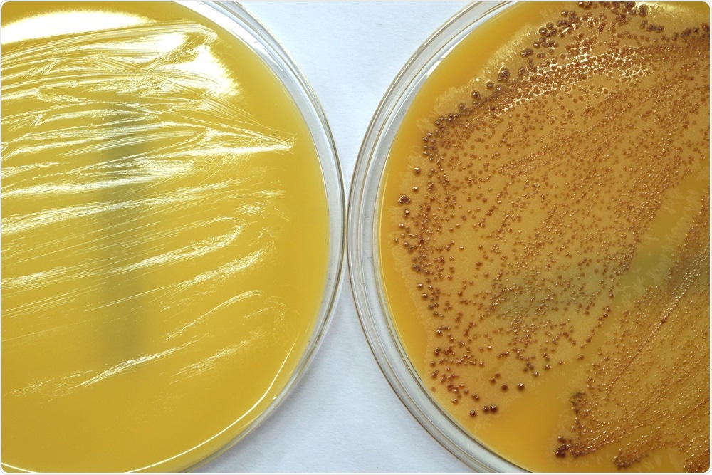 Positive and negative MRSA culture