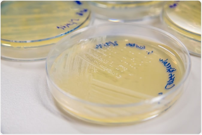 Methicillin-Resistant Staphylococcus aureus (MRSA) cross-streak culture on an agar plate. Image Credit: SubstanceTproductions / Shutterstock