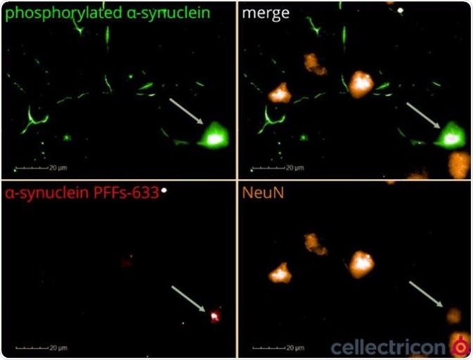 ICC of primary mouse cortical neurons seeded with ATTO633-labelled α-synucleinPFFs (SPR-322)
