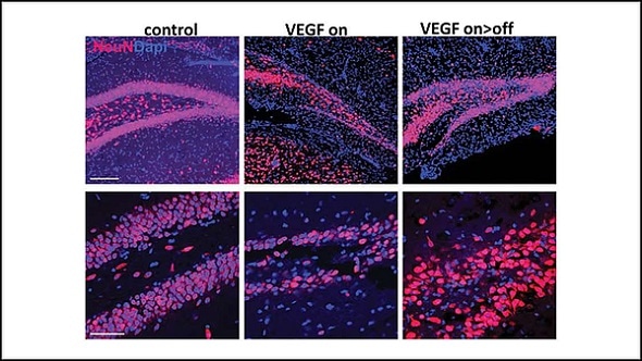 Research suggests a new role for neurogenesis Research suggests a new role for neurogenesis