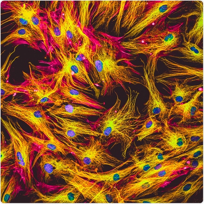 Fluorescence Microscopy