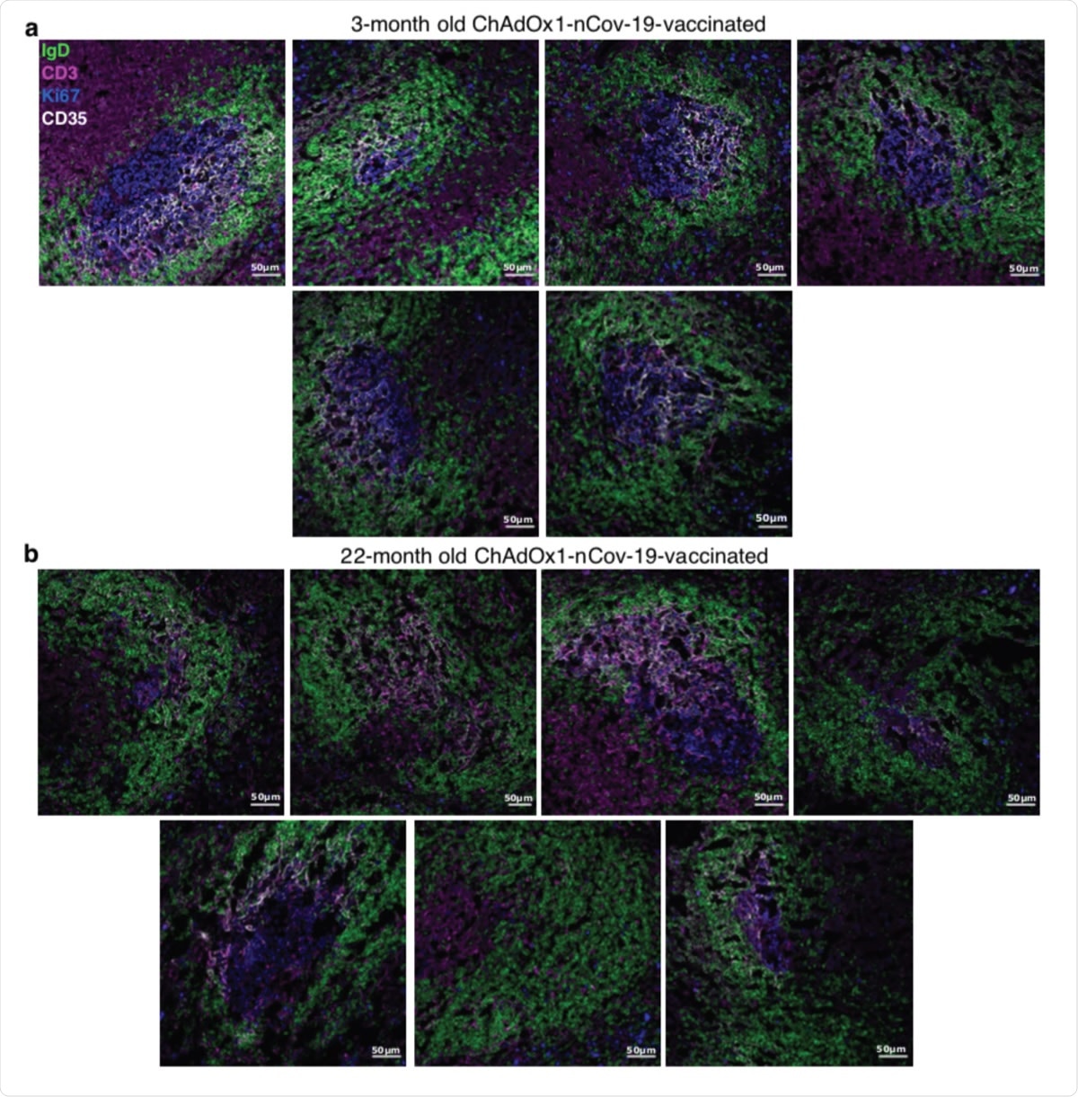Germinal centre images nine days after ChAdOx1 nCoV-19 immunisation in adult and aged mice. Confocal images of the spleen of ChAdOx1 nCoV-19 immunised 3-month-old (a) and 22-month-old (b) mice. 10 μm spleen sections were stained with anti-IgD (green), anti-CD3 (pink), anti-Ki67 (blue) and anti-CD35 (white) antibodies. Each image is from a different mouse. The scale bars indicate 50μm.
