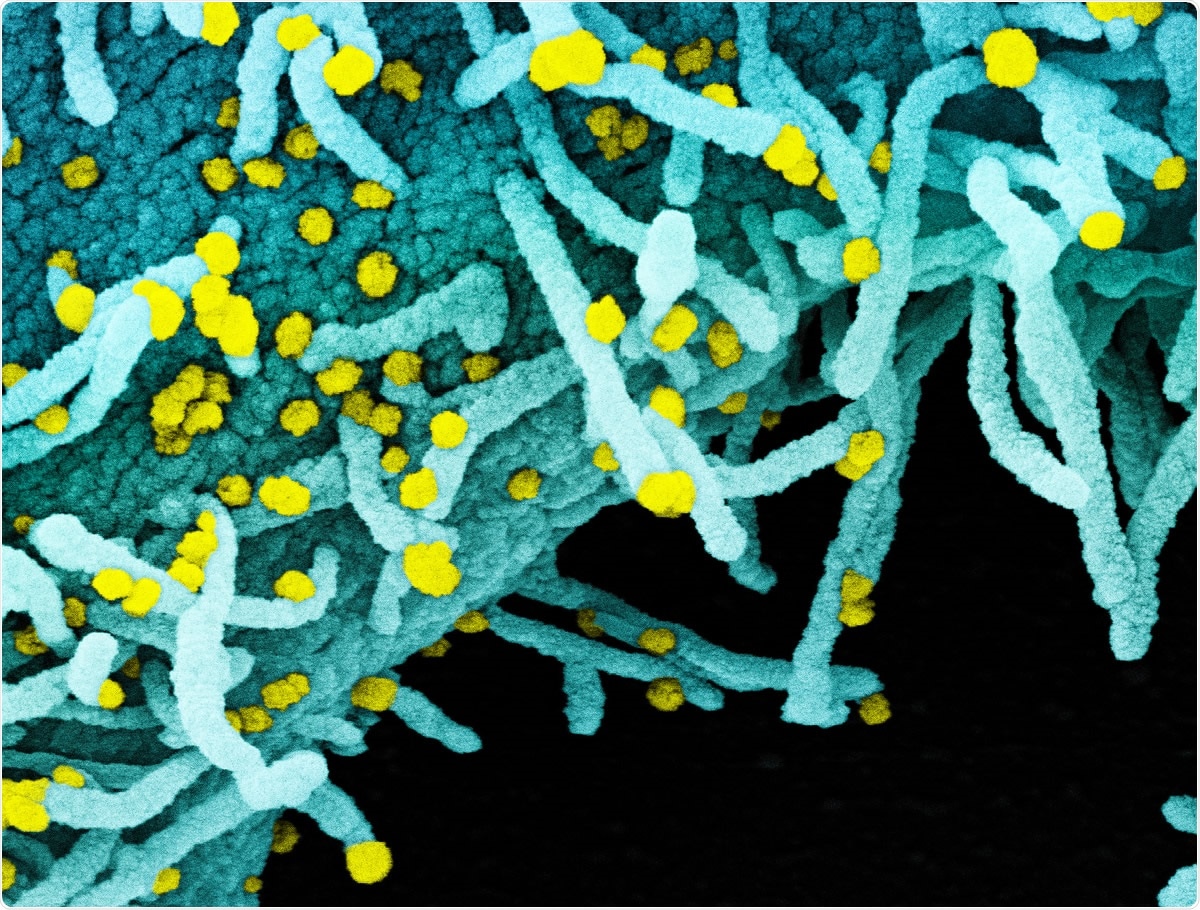 Study: Alternate primers for whole-genome SARS-CoV-2 sequencing.