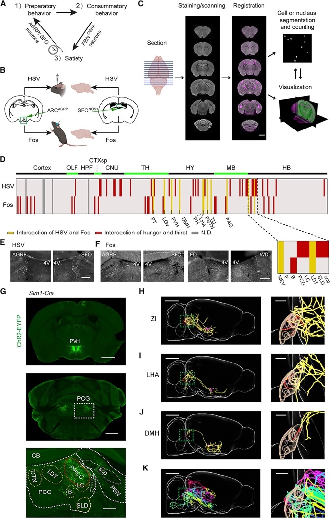 Brain Mapping Downstream of AGRP or SFONOS1 Neurons