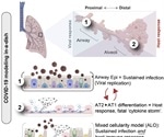 Adult stem cell-based lung organoid models emulate host immune response in fatal COVID-19