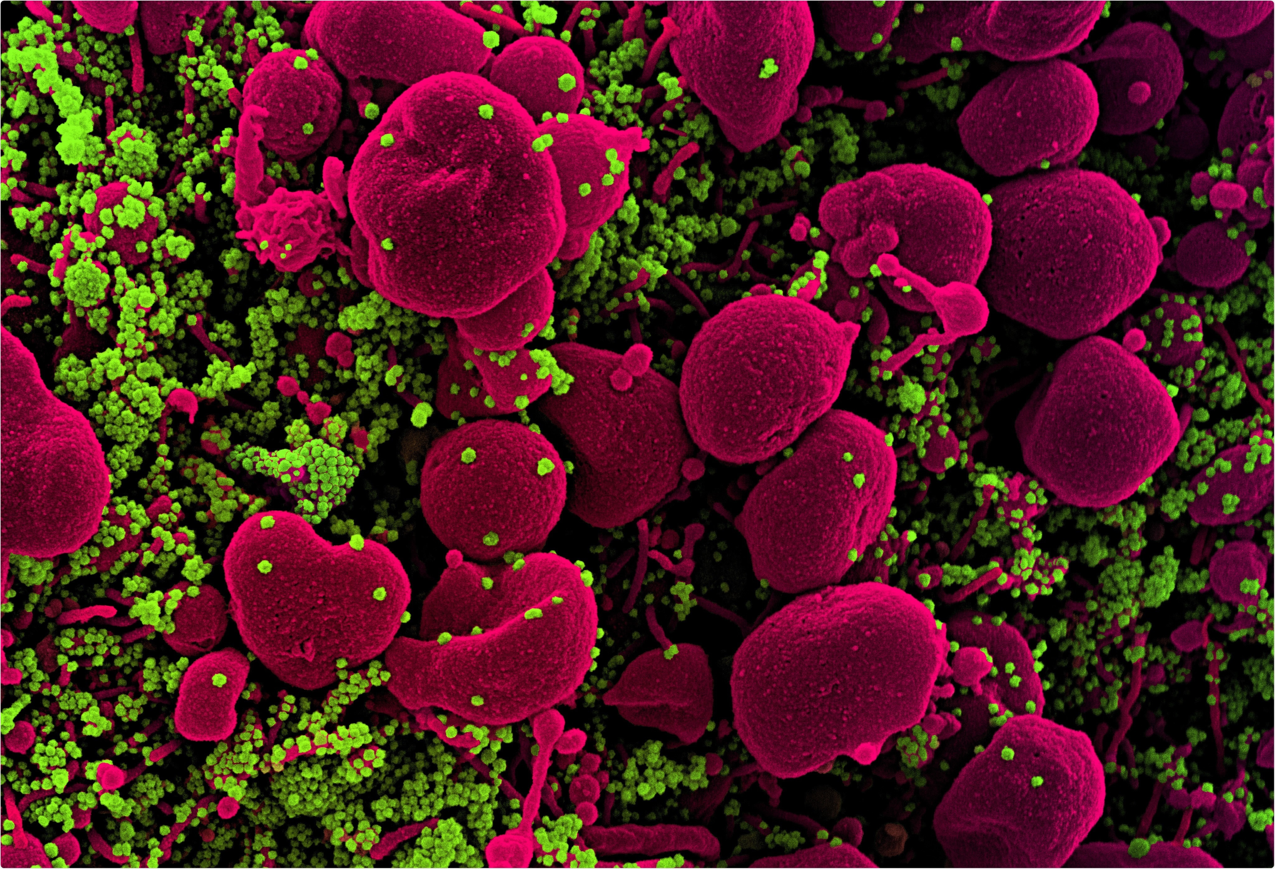 Study: The N-terminal domain of spike glycoprotein mediates SARS-CoV-2 infection by associating with L-SIGN and DC-SIGN. Image  Credit: NIAID