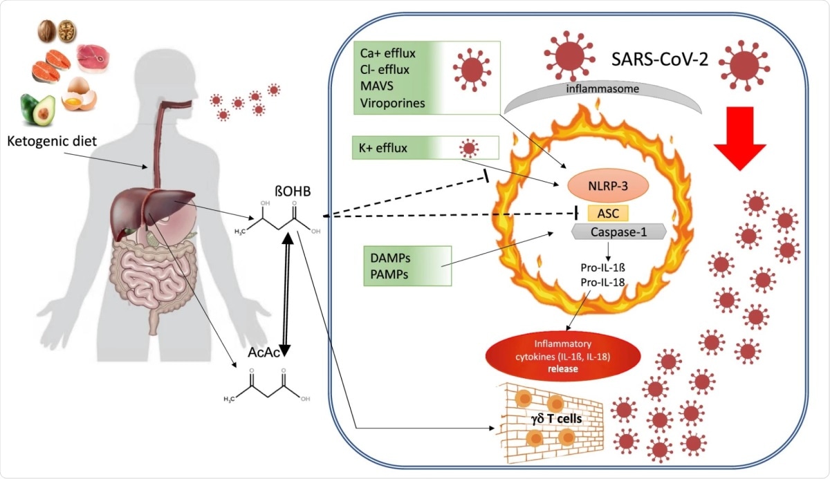 Ketone bodies and NLRP3/inflammasome activation. Protective effects of ketogenic diet and ßOHB on risk conditions associated with serious COVID-19 disease. ßOHB: Beta-hydroxybutyrate, AcAc: AcetoAcetate, MAVS: mitochondrial antiviral signalling protein, LPS: lipopolysaccharide, NLP3: NOD-, LRR- and pyrin domain-containing protein 3, ASC: Adaptor apoptosis associated Speck-like protein containing a Caspase Recruitment Domain (CARD), Pro-IL-1ß: pro-interleukin 1 beta, Pro-IL-18: pro-interleukin 18, DAMPs: damage-associated molecular patterns; PAMPs: pathogen-associated molecular patterns.