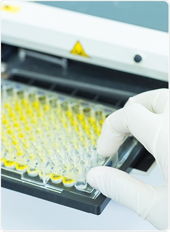 Anti-Human Secondary Antibodies and their Importance in Serological Testing