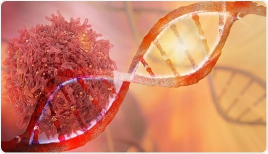 CEAT project for improving ovarian cancer diagnosis, treatment shows promise CEAT project for improving ovarian cancer diagnosis, treatment shows promise