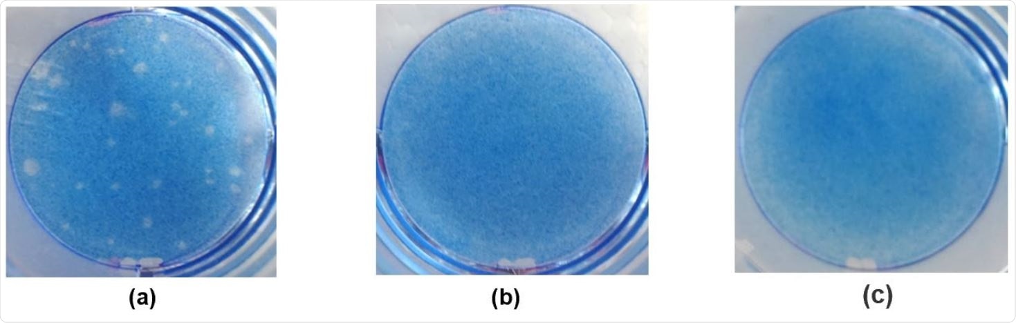 Plaque formation in Vero cells. Virus solutions were exposed to ozone water for 5 sec and subjected to a plaque assay. (a) virus + tap water (no ozone), (b) virus + 7 mg/L ozone water or (c) mock-infected cells.