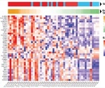 Topoisomerase 1 inhibition prevents SARS-CoV-2-induced inflammation and death in animal models