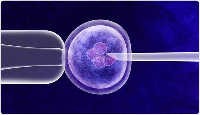 Image Credit: Lightspring / Shutterstock