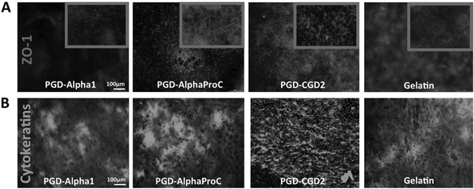 Characterization of typical epithelial markers. A) ZO-1 marker and B) multipanel of  cytokeratins expression by mOECs cultured on the surface of optimal peptide hydrogels at day 3. Scale bar = 100 μm. Image Credit: Manchester BIOGEL