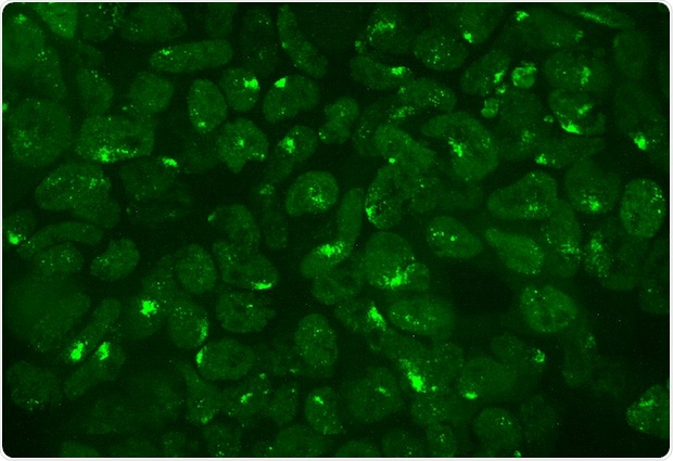 Research provides new insights into molecular basis of X-chromosome inactivation