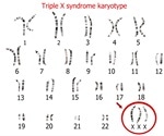 What is Triple X Syndrome?