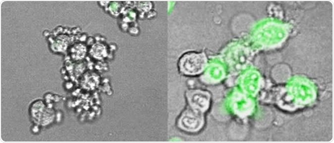 At left, cancer cells from an immunologically