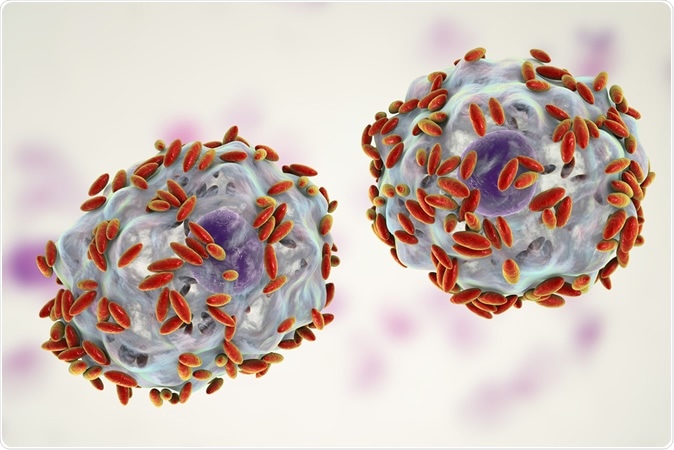 Microscopic diagnosis of bacterial vaginosis. Vaginal secretions contain epithelial cells, so-called clue cells covered with bacteria Gardnerella vaginalis, 3D illustration. Image Credit: Kateryna Kon