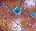 Restoring brain energy balance reverses advanced Alzheimer’s disease in mouse models