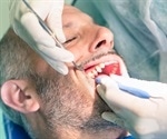 Are opioids necessary after tooth extraction?