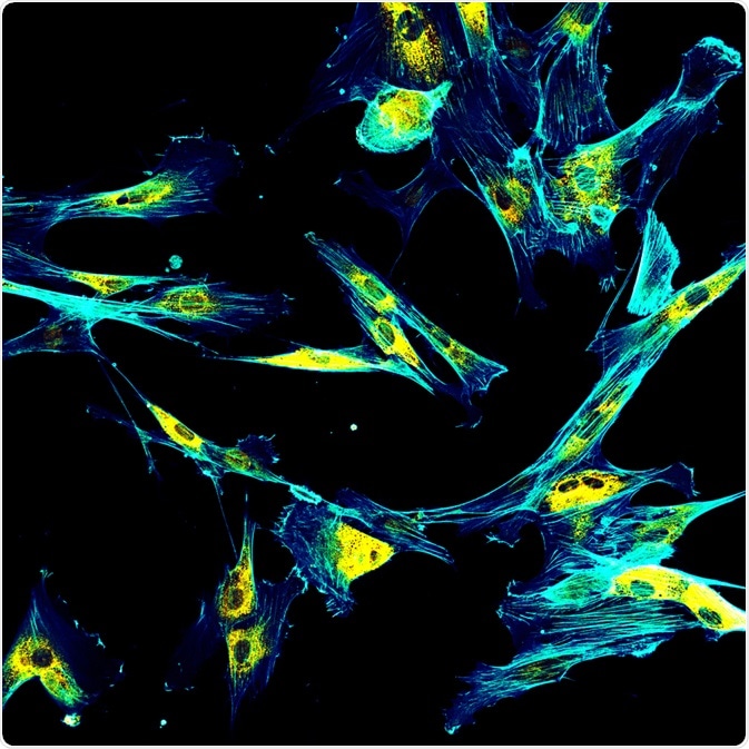 Fibroblasts