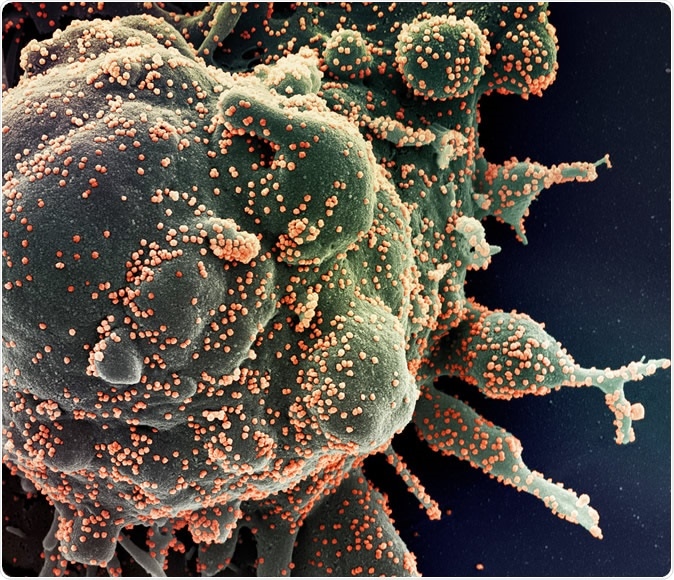 Colorized scanning electron micrograph of an apoptotic cell (green) heavily infected with SARS-COV-2 virus particles (orange), isolated from a patient sample. Image captured at the NIAID Integrated Research Facility (IRF) in Fort Detrick, Maryland. Credit: NIAID
