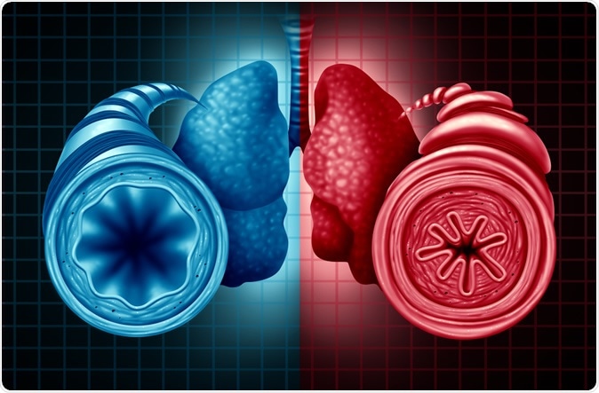 Image Credit: Lightspring / Shutterstock