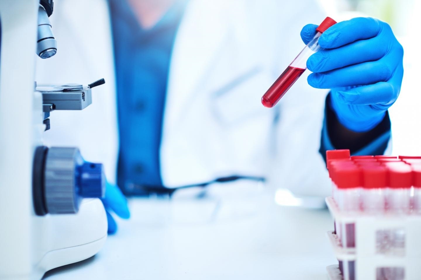 pancreatic cancer blood test