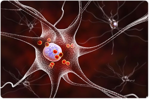 Recent Research Into Neurodegenerative Diseases Recent Research Into Neurodegenerative Diseases