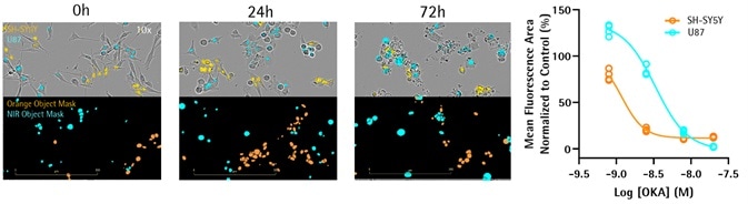 Neuronal and Microglial Analysis for Alzheimer’s Disease Models