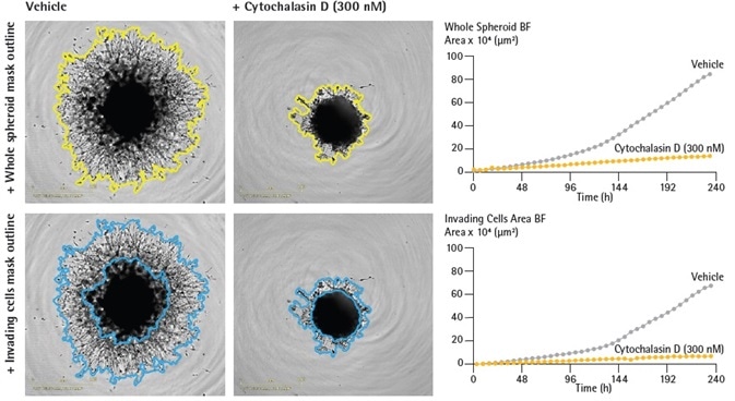 Quantification of single spheroid invasion using IncuCyte® real-time analysis. U87-MG cells were seeded in a ULA round bottom 96-well plate (2,500 cells/well) and allowed to form spheroids for 3 days. Spheroids were subsequently treated with vehicle or Cytochalasin D (Cyto D) prior to embedding in Matrigel (4.5 mg/mL). IncuCyte depth of focus brightfield (DF-BF) images (5 d post treatment) show effect of Cyto D on spheroid invasion (whole spheroid; yellow outline mask or invading cells; blue outline mask). Note extensive invasive phenotype of vehicle treated compared to Cyto D treated spheroids. Time-course plots show the individual well BF area (whole spheroid or invading cell areas, μm2) over time (h). Data were collected over a 240 h period at 6 h intervals. All images captured at 4x magnification. Each data point represents mean ± SEM,