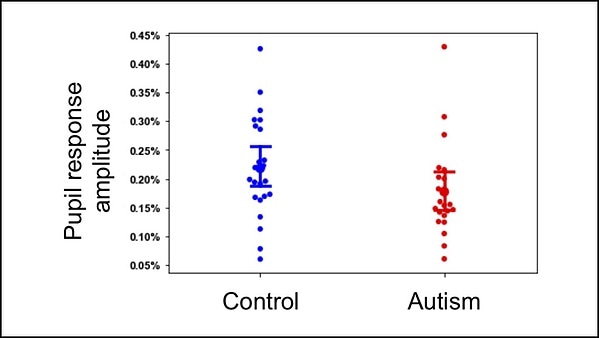 Dysregulation in the brainstem may explain atypical attentional behaviors in people with autism