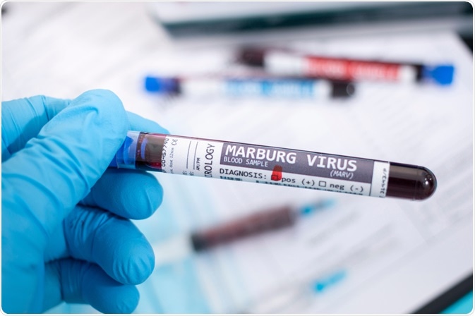 Marburg Virus